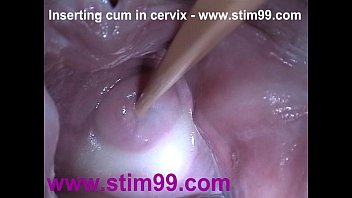 Cervix stretching wide with speculum sperm