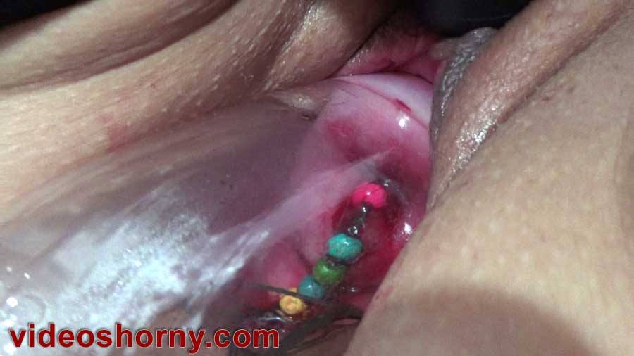 Lady L. reccomend inflation catheter inside hole pull