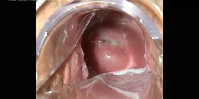 girl orgasm filmed from inside vagina.